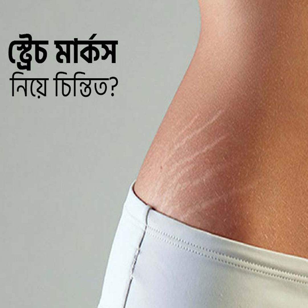 অ্যাডভান্সড স্কার জেল  স্ট্রেচ মার্কস দূর করুন