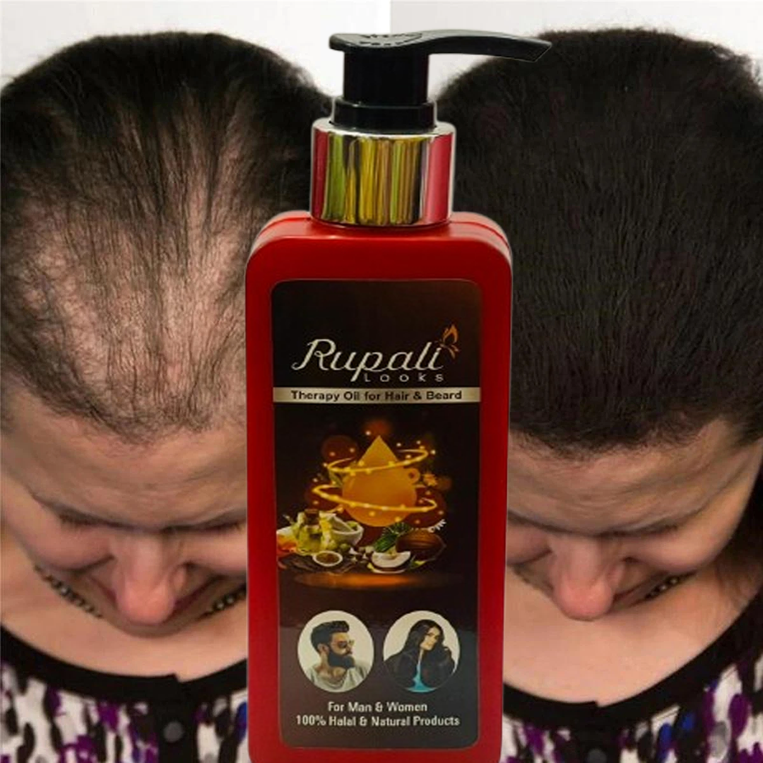 থেরাপি তেল 200ML,  BSTI  অনুমোদিত,  টাক মাথার সমাধান