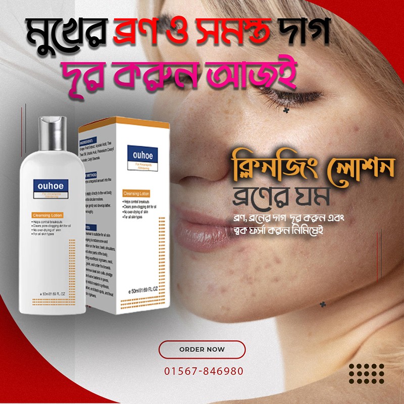 চায়না ouhoe ক্লিনজিং লোশন ১টির দামে ৩টি - গোপনাঙ্গের কালো দাগ দূর করুন