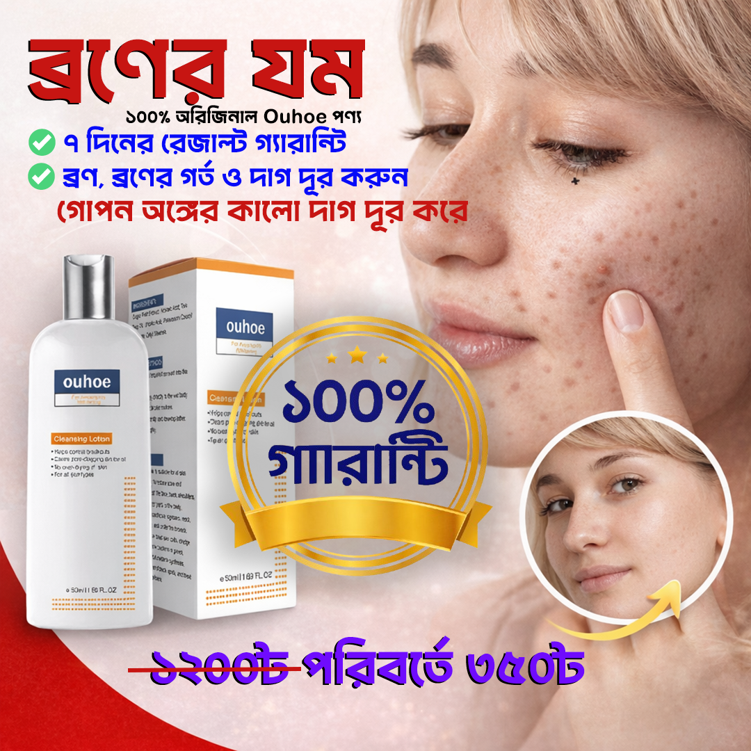 চায়না ouhoe ক্লিনজিং লোশন গোপন অঙ্গের কালো দাগ, ব্রণ এবং ব্রণের গর্ত কালো দাগ দূর করার লোশন